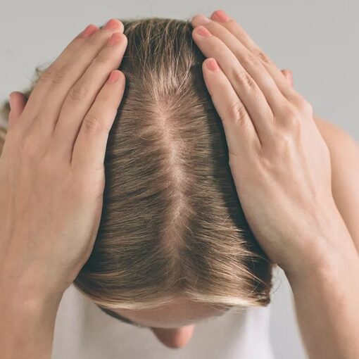 Scalp Exfoliation with Mask & Hydration